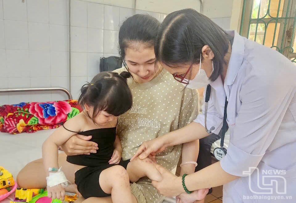 Số ca bệnh tay chân miệng gia tăng