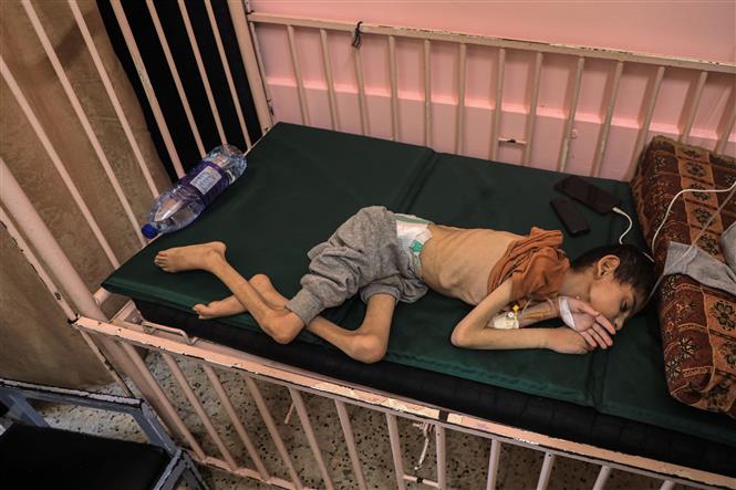 Bi kịch trẻ em Gaza chết đói trong vòng tay mẹ