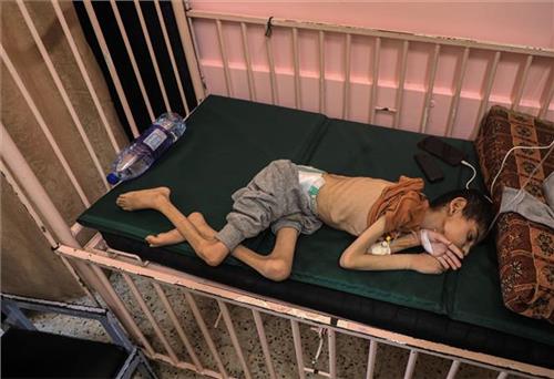 Bi kịch trẻ em Gaza chết đói trong vòng tay mẹ